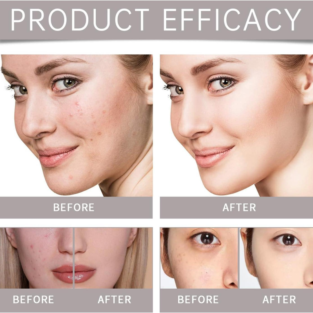 Teashell Niacinamide Brightening Serum | Fade Dark Spots, Acne Marks & Even Skin Tone