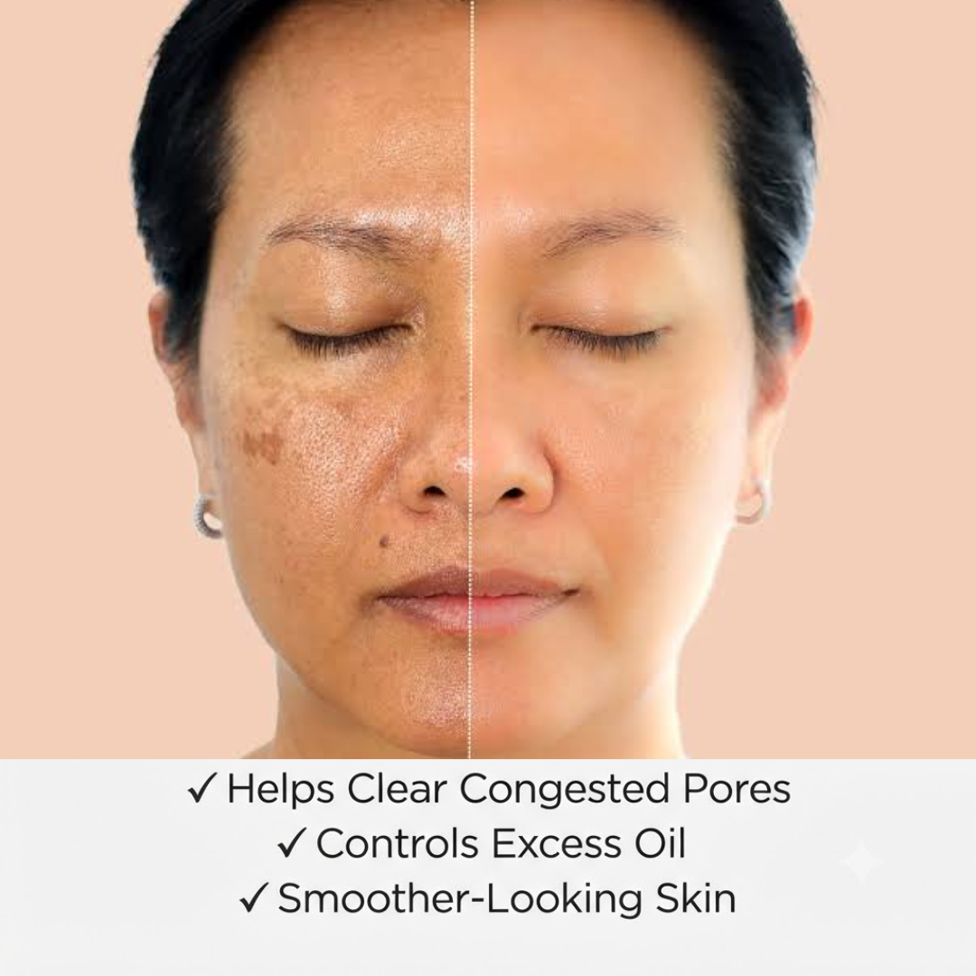 Green Tomato Clay Pack Cleanser – 2-in-1 Mask + Cleanser – Pore Purifying, Oil Control & Blackhead Care – For Enlarged Pores, Oily Skin & Uneven Texture – 120ml