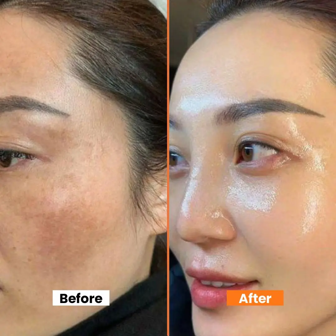 Green Tomato Clay Pack Cleanser – 2-in-1 Mask + Cleanser – Pore Purifying, Oil Control & Blackhead Care – For Enlarged Pores, Oily Skin & Uneven Texture – 120ml
