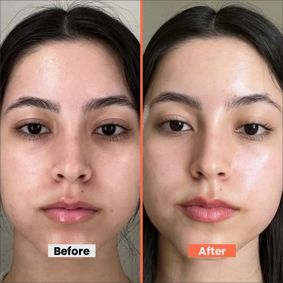 Foxtale Fluid Sunscreen with Niacinamide & Tinted Fluid Sunscreen Duo | SPF 50, Oil Control, Pore Blurring & Skin Brightening for All Skin Types
