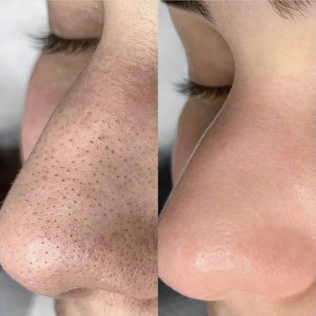 Green Tomato Clay Pack Cleanser – 2-in-1 Mask + Cleanser – Pore Purifying, Oil Control & Blackhead Care – For Enlarged Pores, Oily Skin & Uneven Texture – 120ml